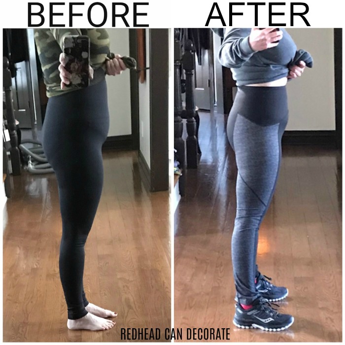 Mom of 2 tells her Laser Lipo/Mini Tummy Tuck Journey with Before & After Photos.  Lots of before and after photos and information you should know before having these procedures.